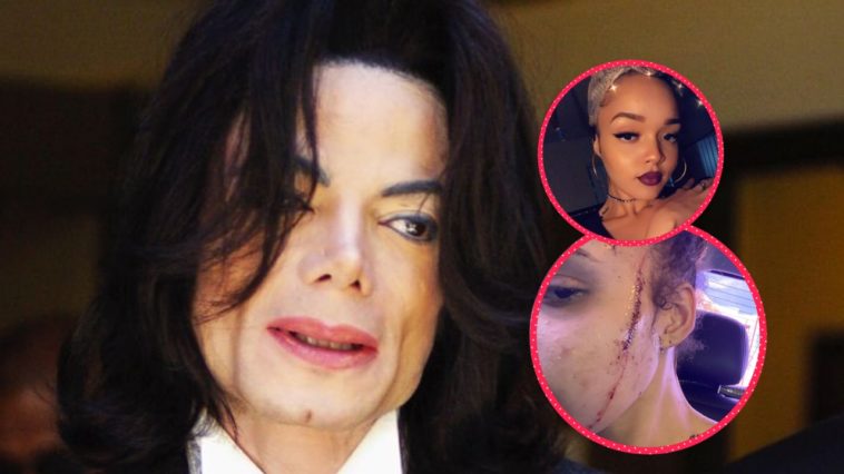 Schock Bei Ausschreitungen Nichte Von Michael Jackson Brutal Zusammengeschlagen Promiwood
